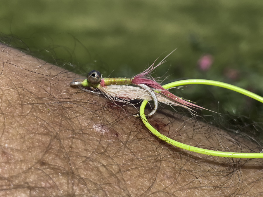 removing fish hooks from anglers